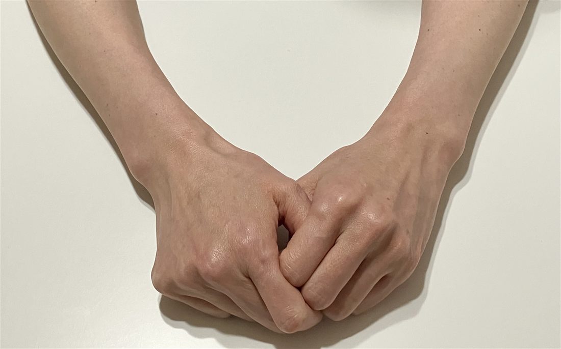 人前で思わず手を隠してしまう様子